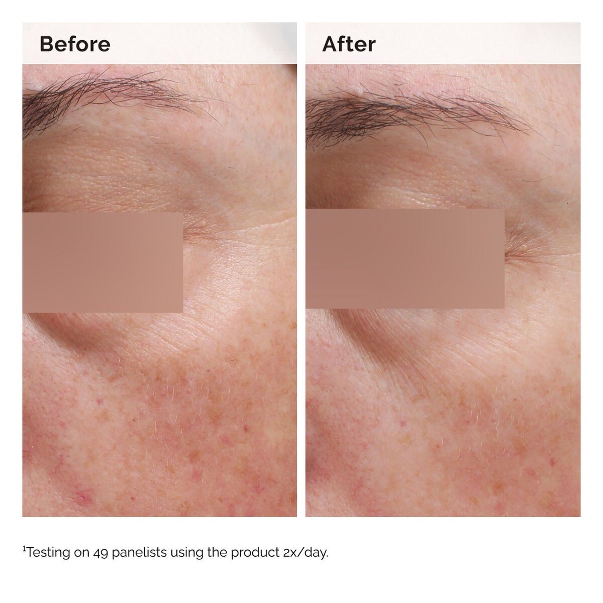 niacinamide-5-face-and-body-emulsion-g2 2024-08-23-ORD-Nia-5pct-Face-Body-B-A-Elasticity-Global-02-1x1.jpg