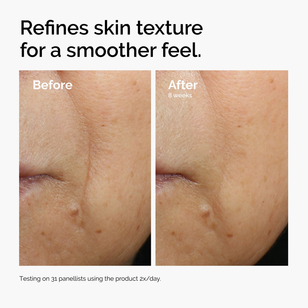 caffeine-3-escin-1-face-serum-l0 ord-caffeine-3pct-escin-1pct-face-serum-before-after-texture.jpg