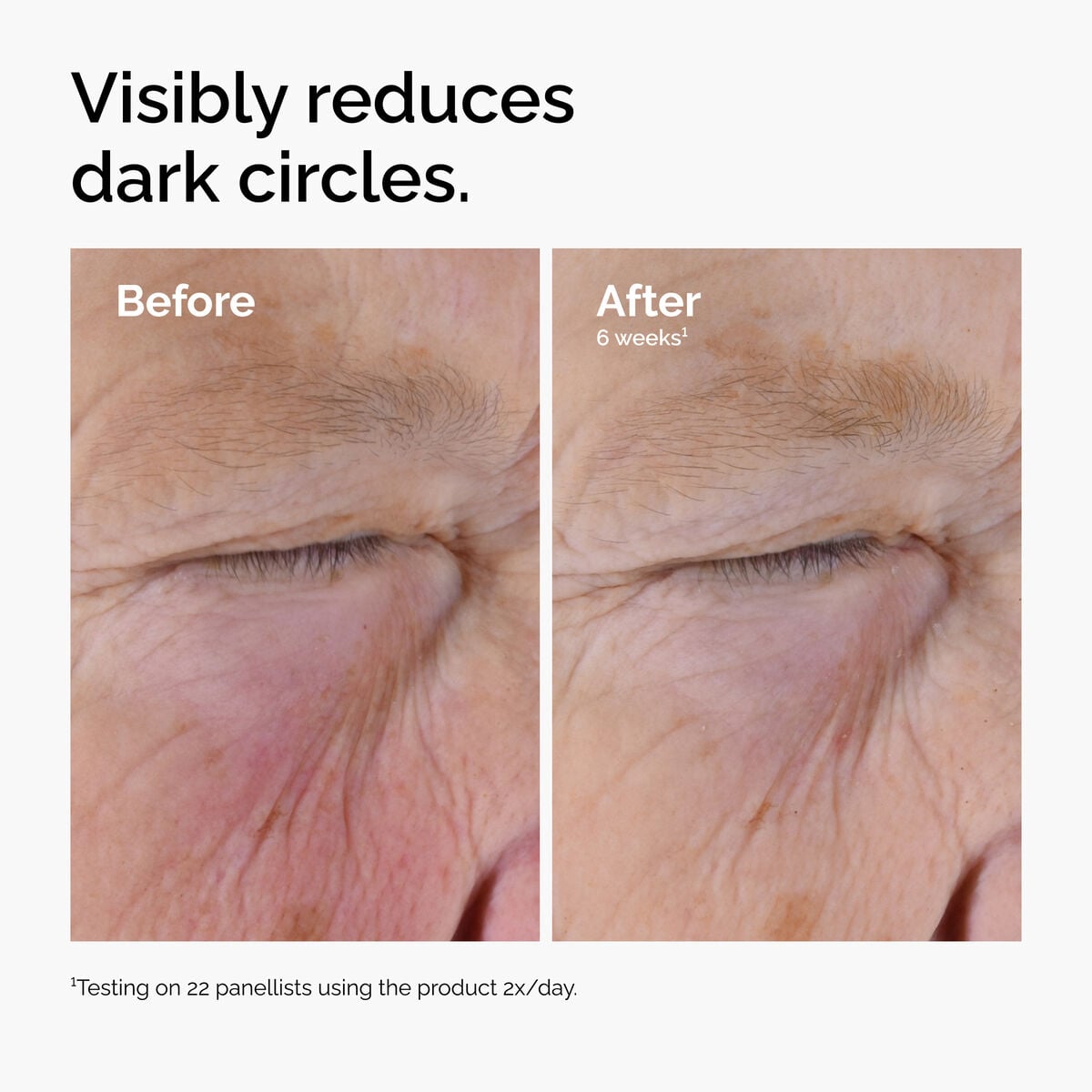 caffeine-solution-5-egcg-eye-serum-x1 ord-caffeine-solution-egcg-dark-circles-before-after.jpg