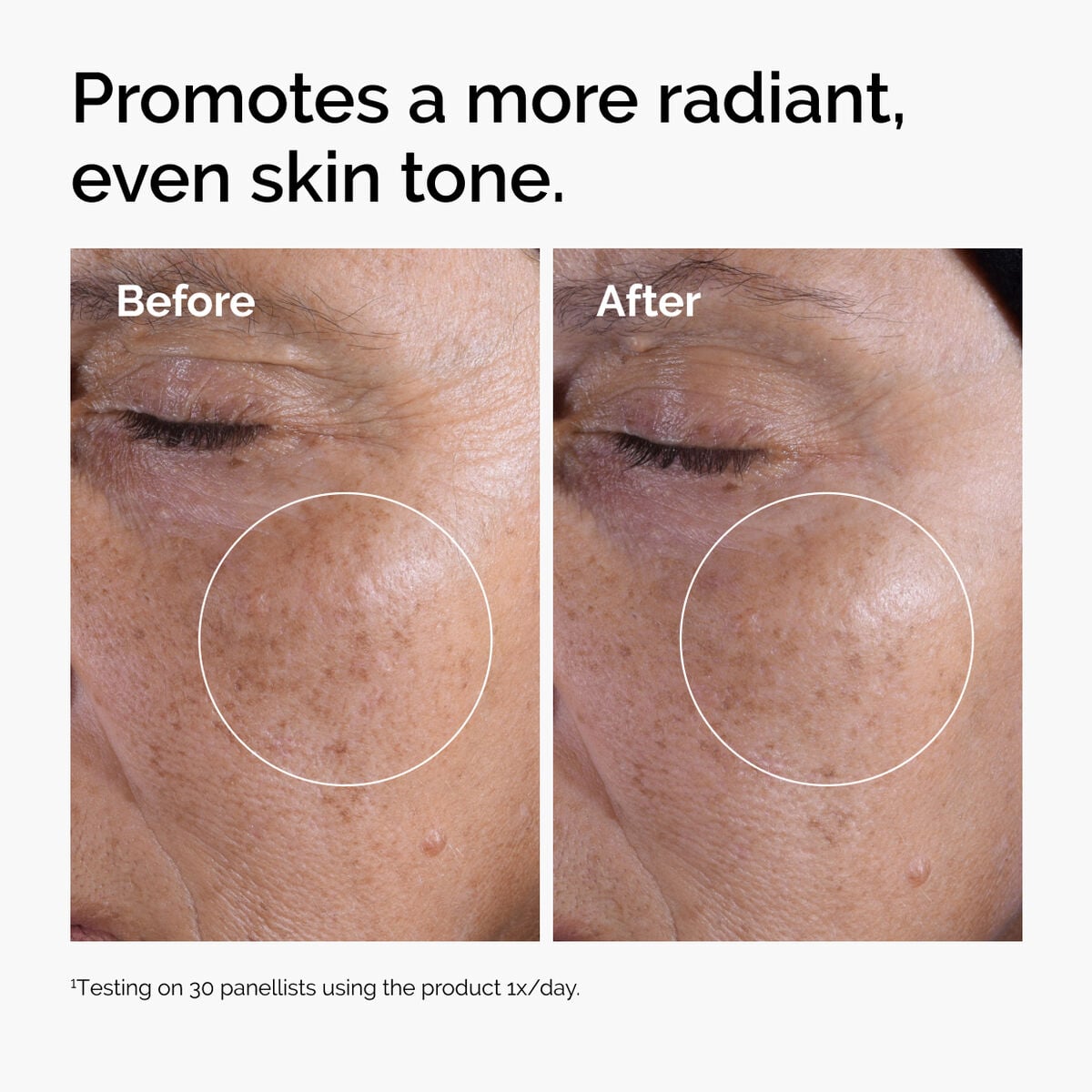 glycolic-acid-7-exfoliating-toner-s1 ord-glycolic-before-after-radiance.jpg