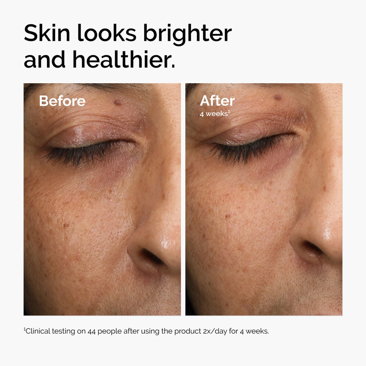 multi-antioxidant-radiance-serum-a3 ord-mars-before-after-healthy.jpg