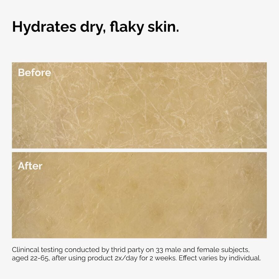 the-body-care-collection-f5 ord-natural-moisturizing-factors-inulin-body-before-after-graphic-02.jpg