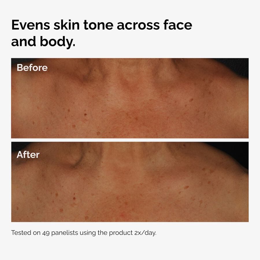 the-body-care-collection-f5 ord-niacinamide-face-body-serum-before-after-even-tone-graphic.jpg